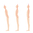 歪んだ背骨骨盤を直したい